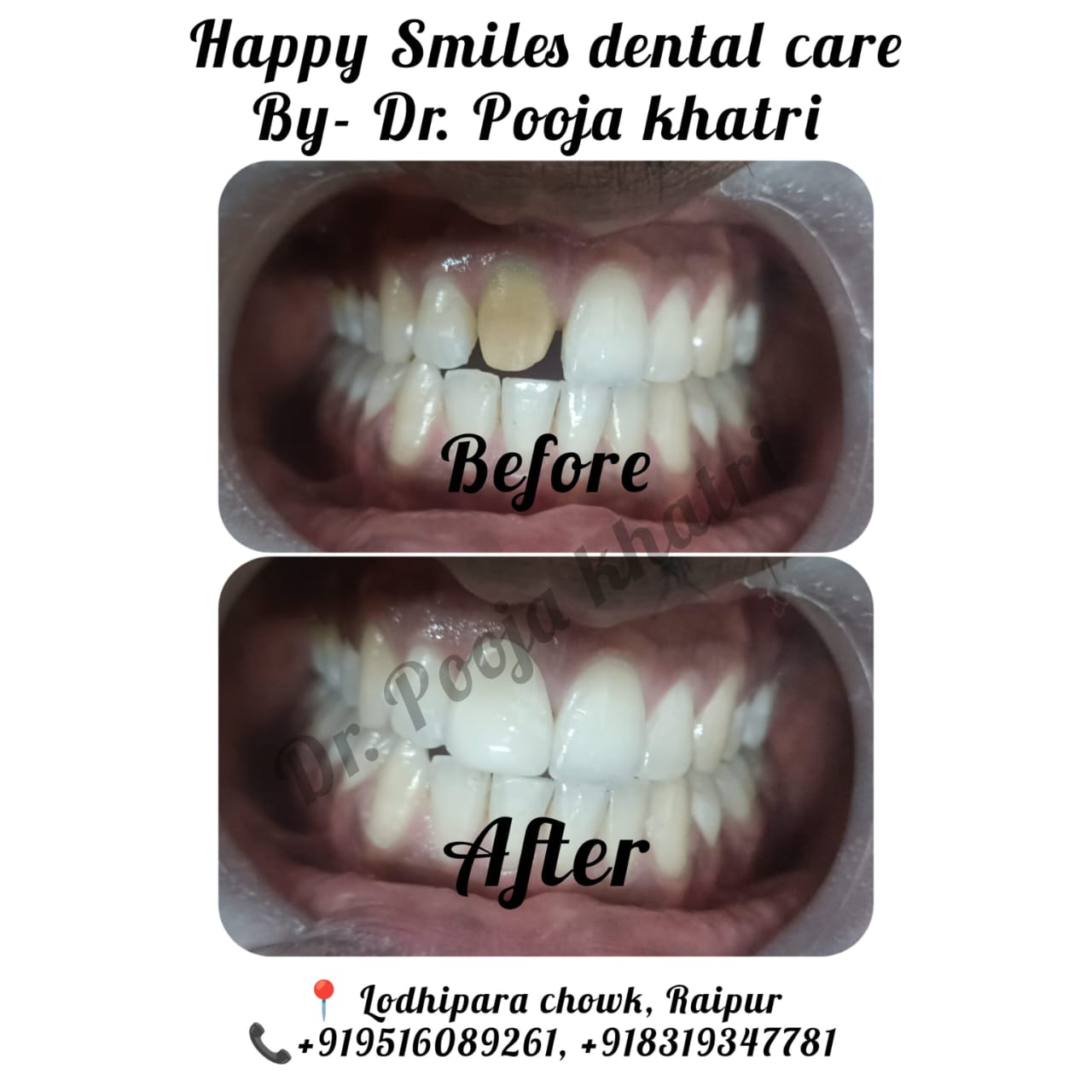 Before Treatment